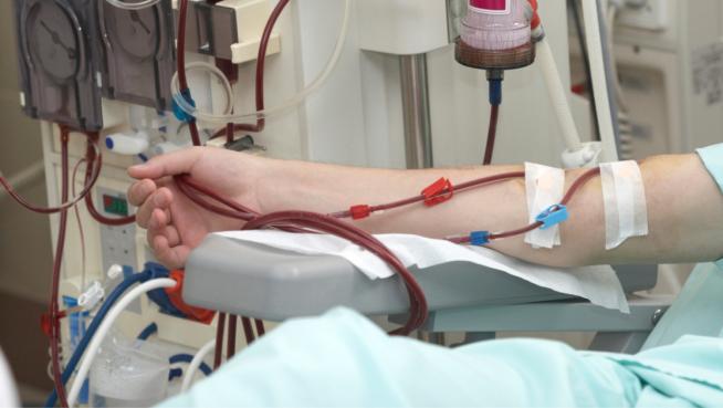 La enfermedad renal crónica aumentó un 30% en España en 10 años