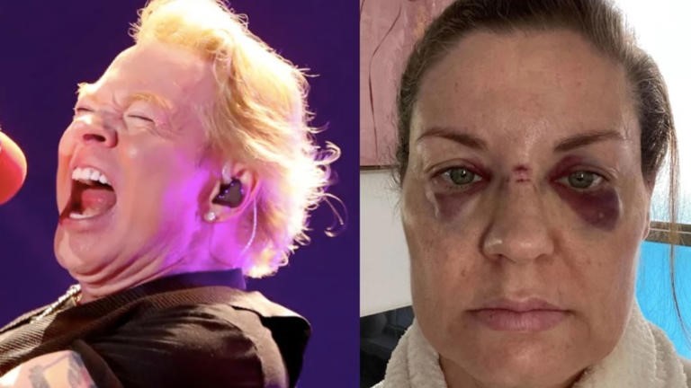 Axl Rose dejará de lanzar micrófono en shows de Guns N’ Roses tras herir a fan