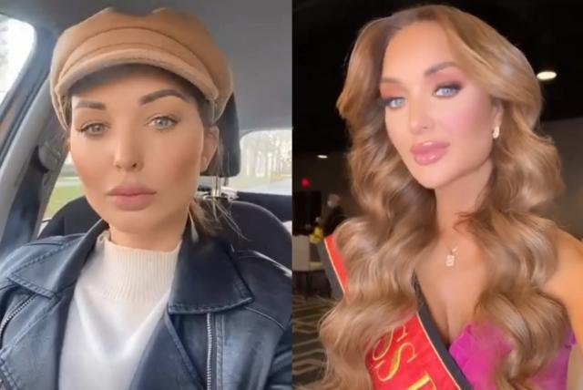 Mis Bélgica fue dada de alta, tras sufrir aparatoso accidente