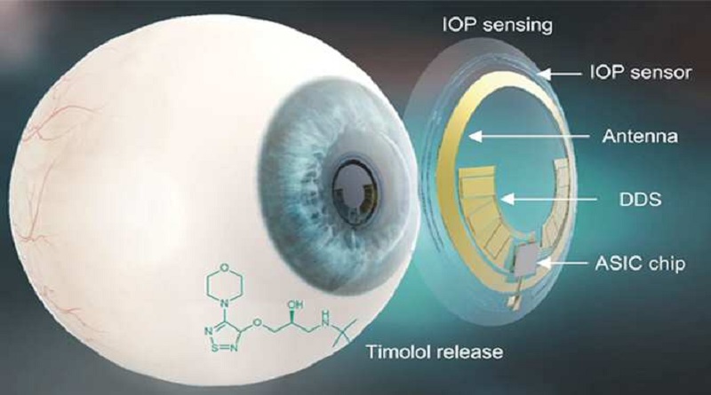 Desarrollan lente de contacto para diagnosticar el glaucoma