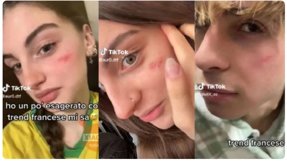 El peligroso reto viral autolesivo de TikTok que prendió las alarmas en Europa