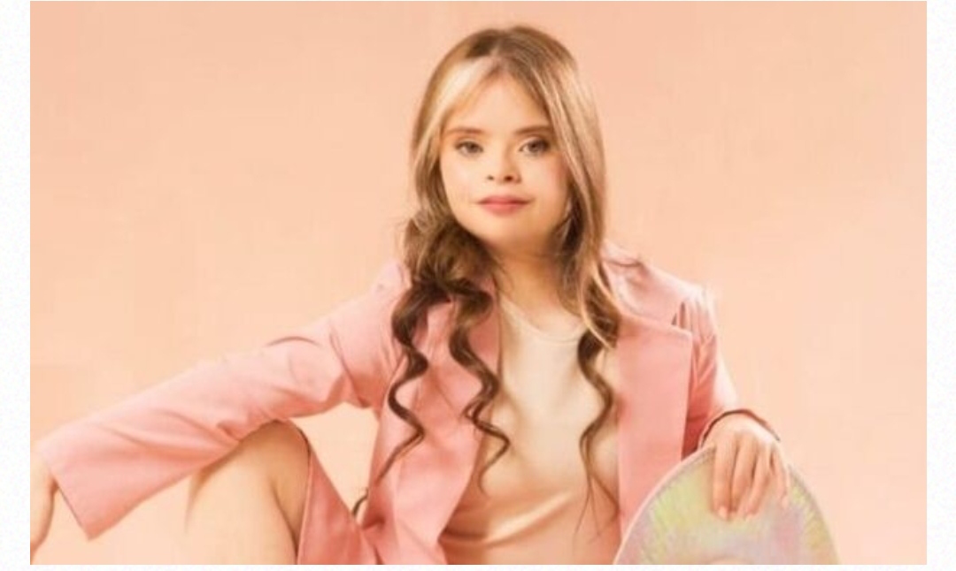 Jessica Jacinto, la modelo venezolana con Síndrome de Down que rompió estereotipos
