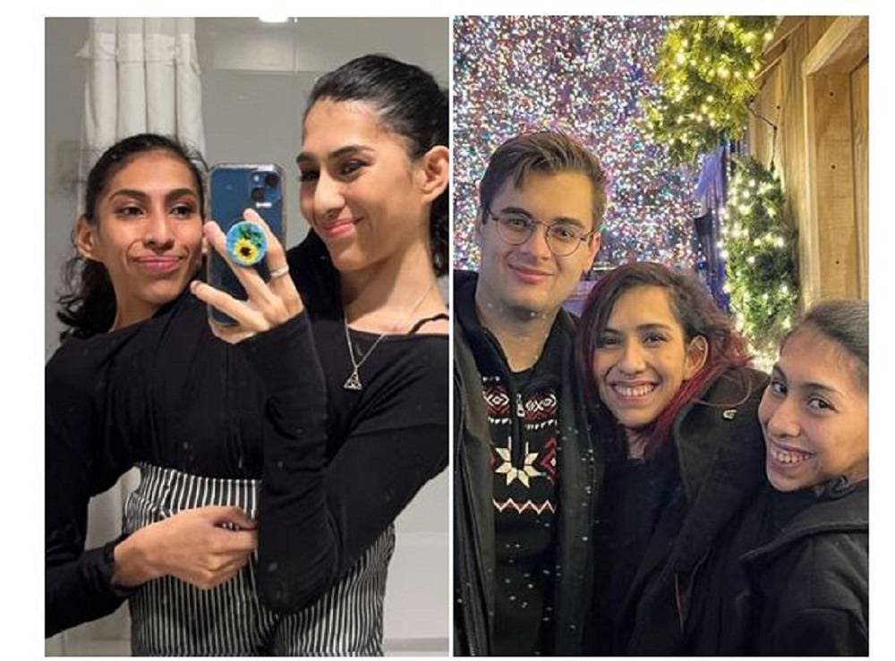 Viral| Carmen y Lupita son siamesas y una de ellas tiene novio: contaron los secretos y acuerdos de la relación