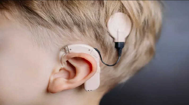 Barinas|Niños podrán escuchar y desarrollar lenguaje con implante coclear