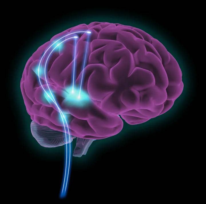 Síndrome de Dravet, una forma de epilepsia que se inicia en la infancia: por qué es clave el diagnóstico temprano