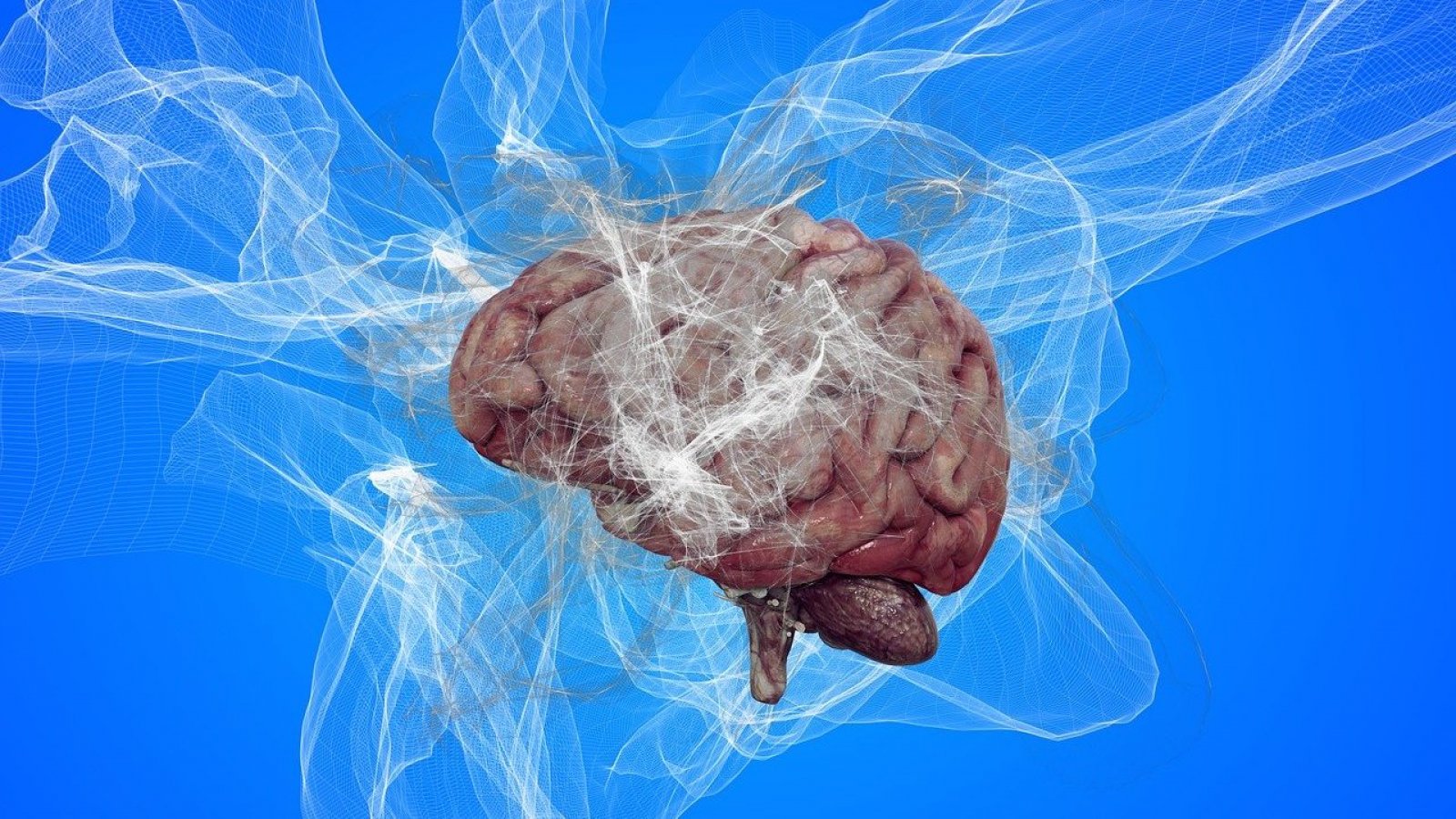 Con precisión del 90%: investigadores crean inteligencia artificial que detecta el Alzheimer