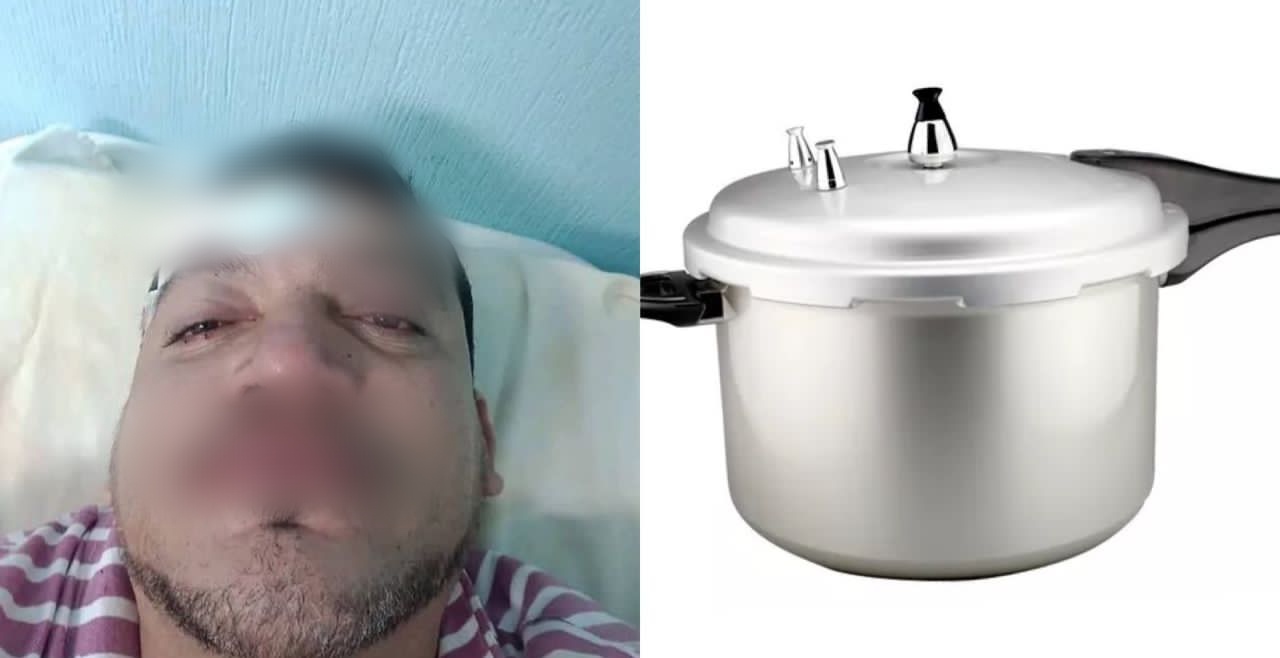 Detienen a una mujer por agredir a su pareja con una olla de presión en el estado Yaracuy