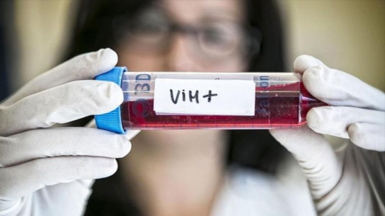 Un nuevo caso de remisión del VIH tras un trasplante de médula ósea