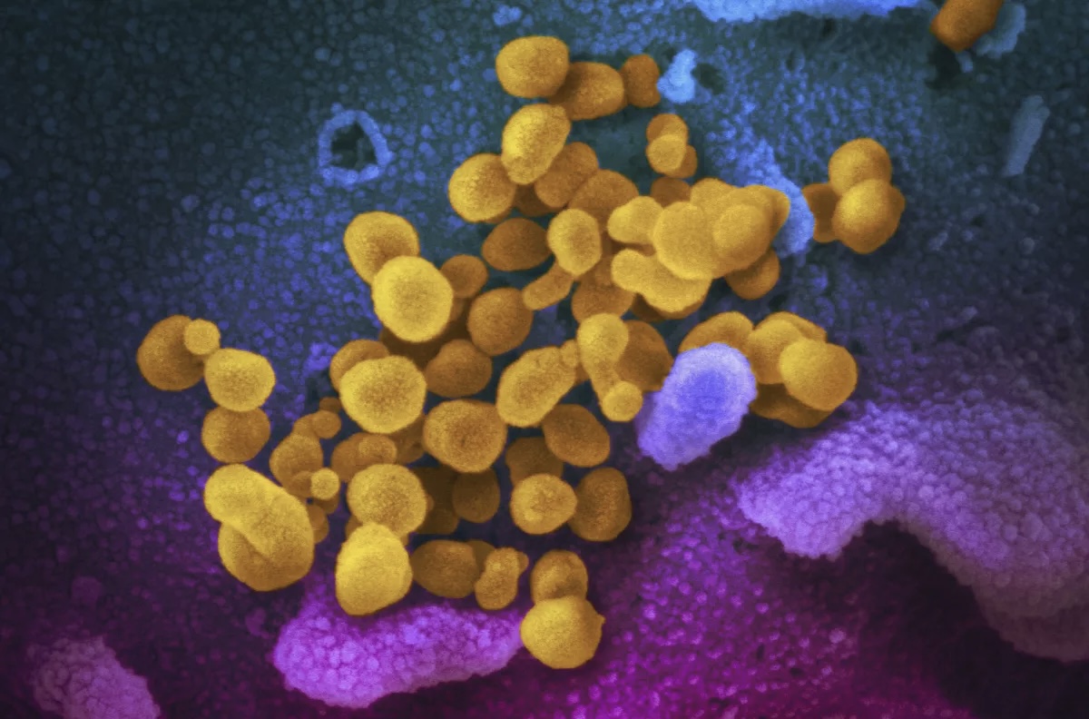 EEUU iniciará estudios sobre tratamientos para secuelas de Covid-19
