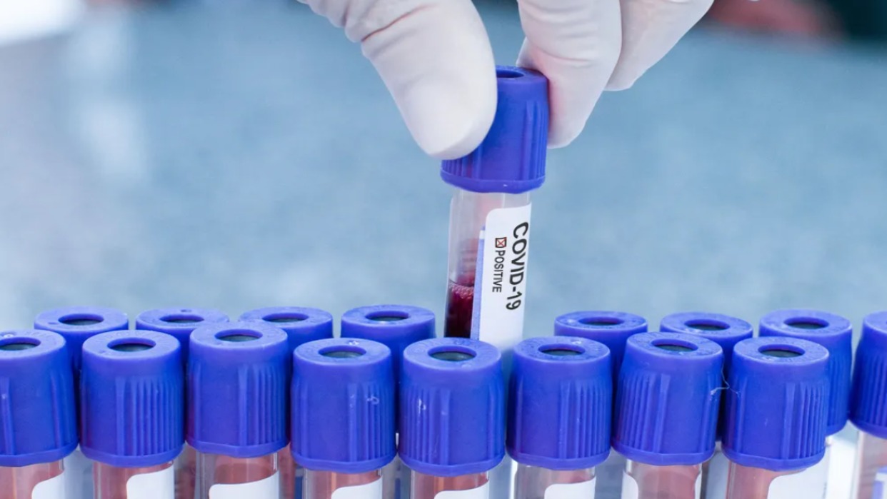 Pirola: la nueva variante del Covid-19 que mantiene en alerta a los científicos