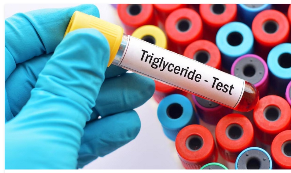 Estos son factores que pueden elevar los triglicéridos en la sangre