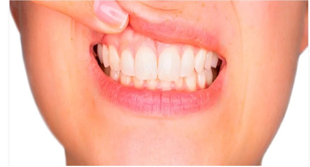 Estrés: respuesta física y mental que también puede afectar la salud dental