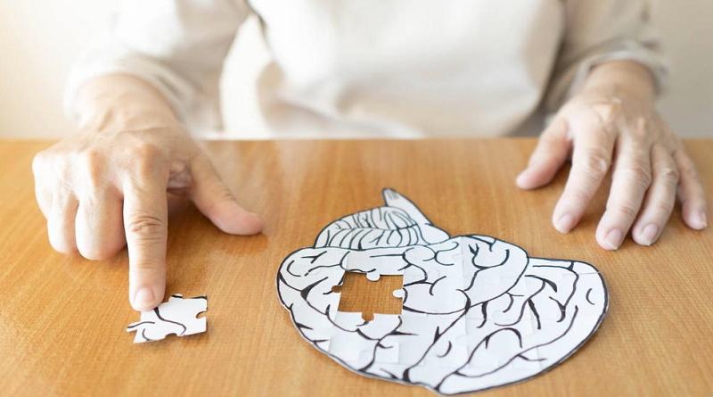 ¿Cuáles son los cuidados ante el Alzheimer?