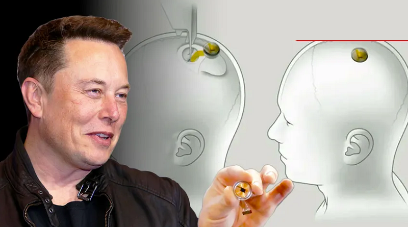 Neuralink comienza reclutamiento de voluntarios para implantes cerebrales