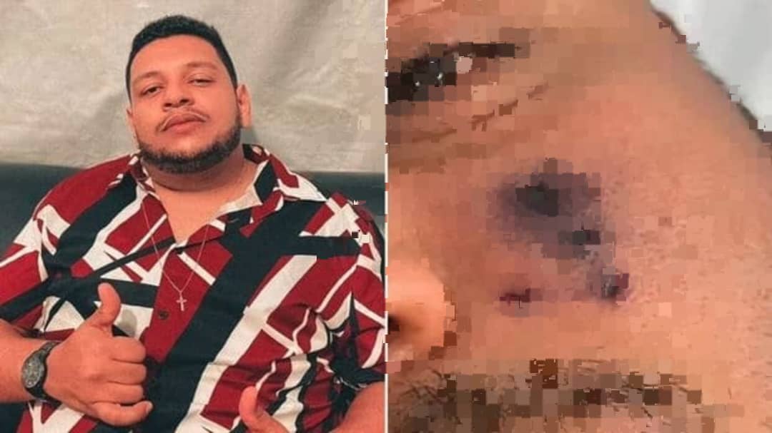 Muere el cantante Darlyn Morais a los 28 años tras ser mordido por una araña