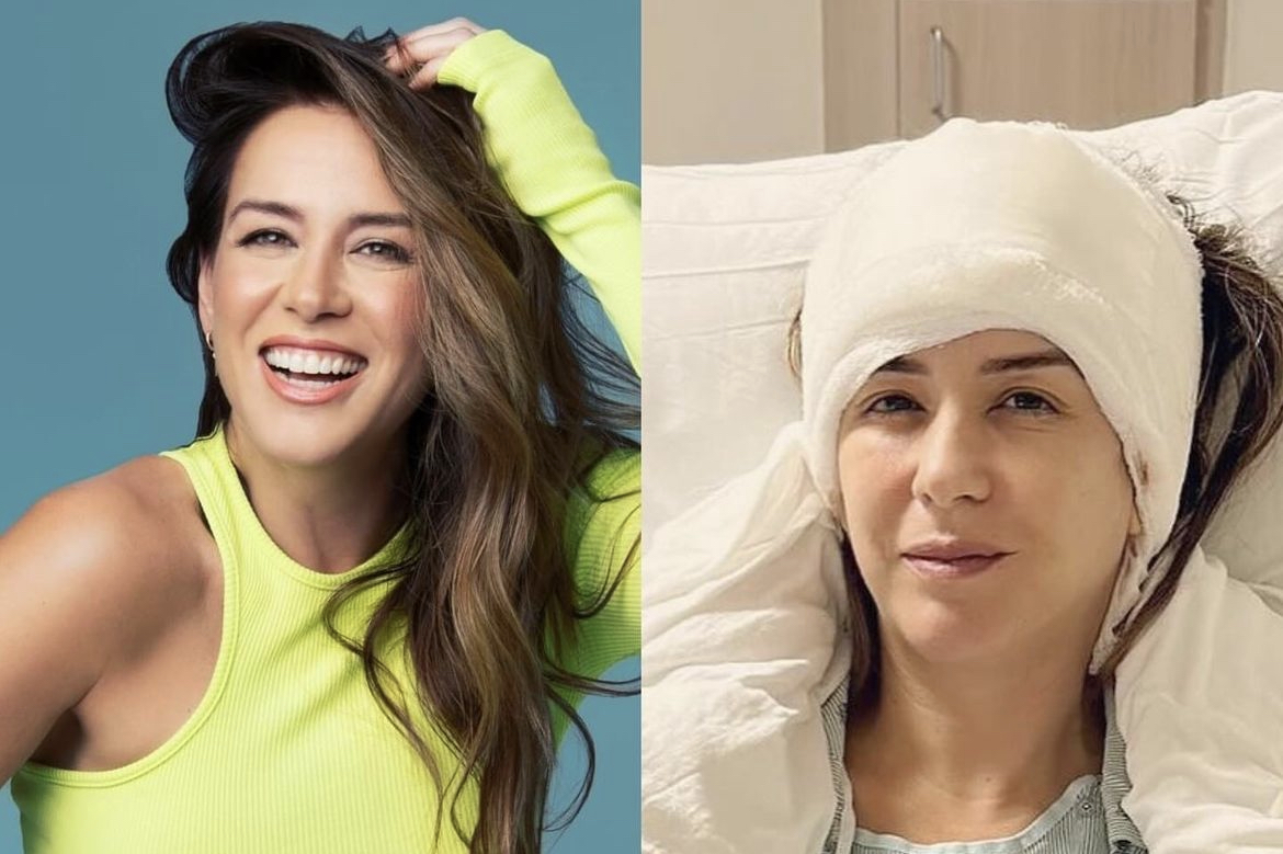 Erika de la Vega reveló que se sometió a una craneotomía tras ser diagnosticada con un “visitante benigno”