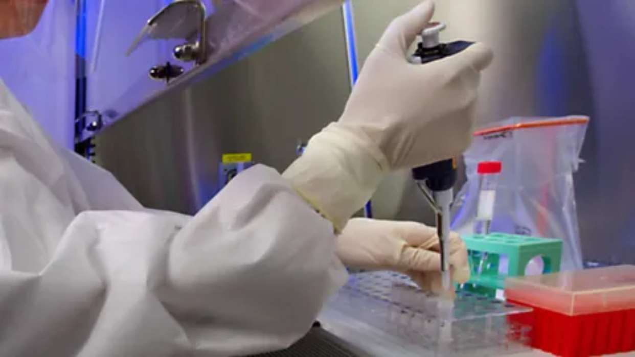 Inyección de células madre promete frenar la esclerosis múltiple