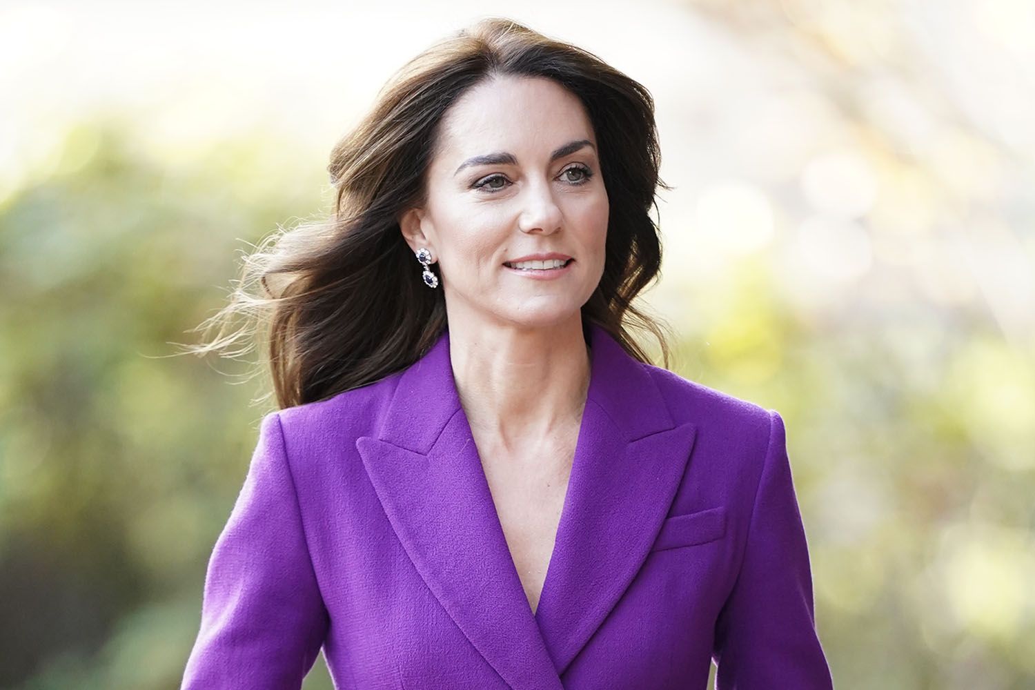 Kate Middleton se sometió a una cirugía abdominal y permanecerá internada de 10 a 14 días