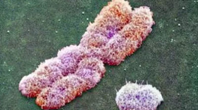 Molécula exclusiva de mujeres podría ser la causa de enfermedades autoinmunes