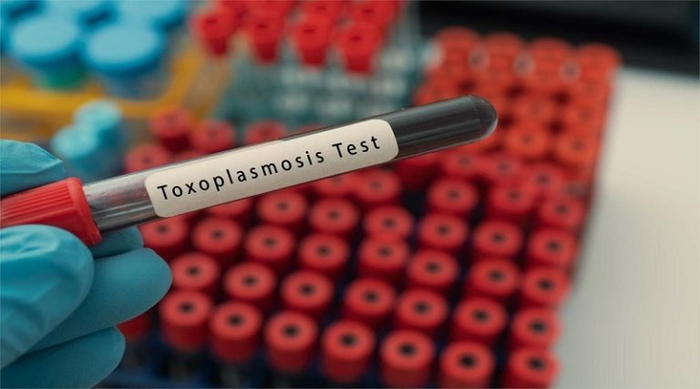 Desarrollan kit para diagnosticar el parásito que causa la Toxoplasmosis