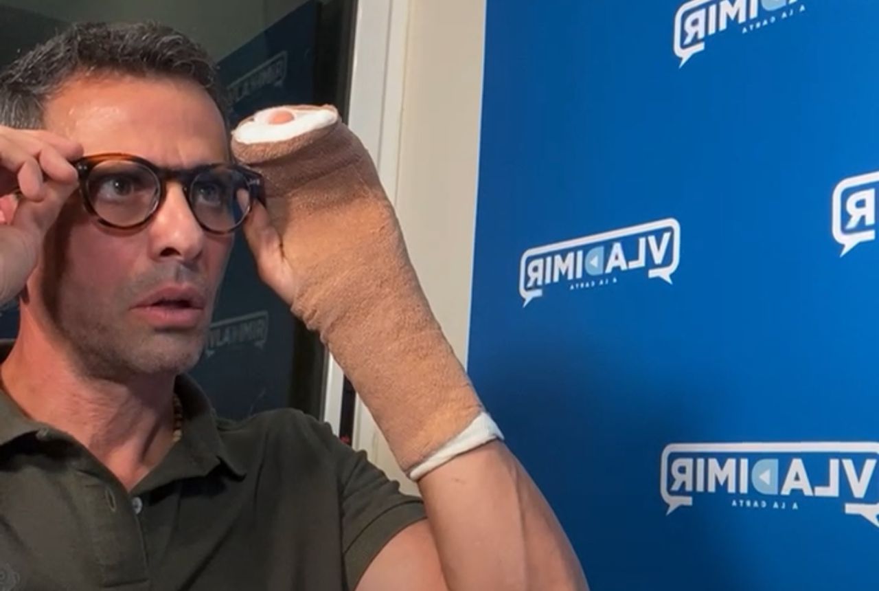 ¿Sufrió accidente? Durante entrevista se vio a Henrique Capriles con una de sus manos enyesada