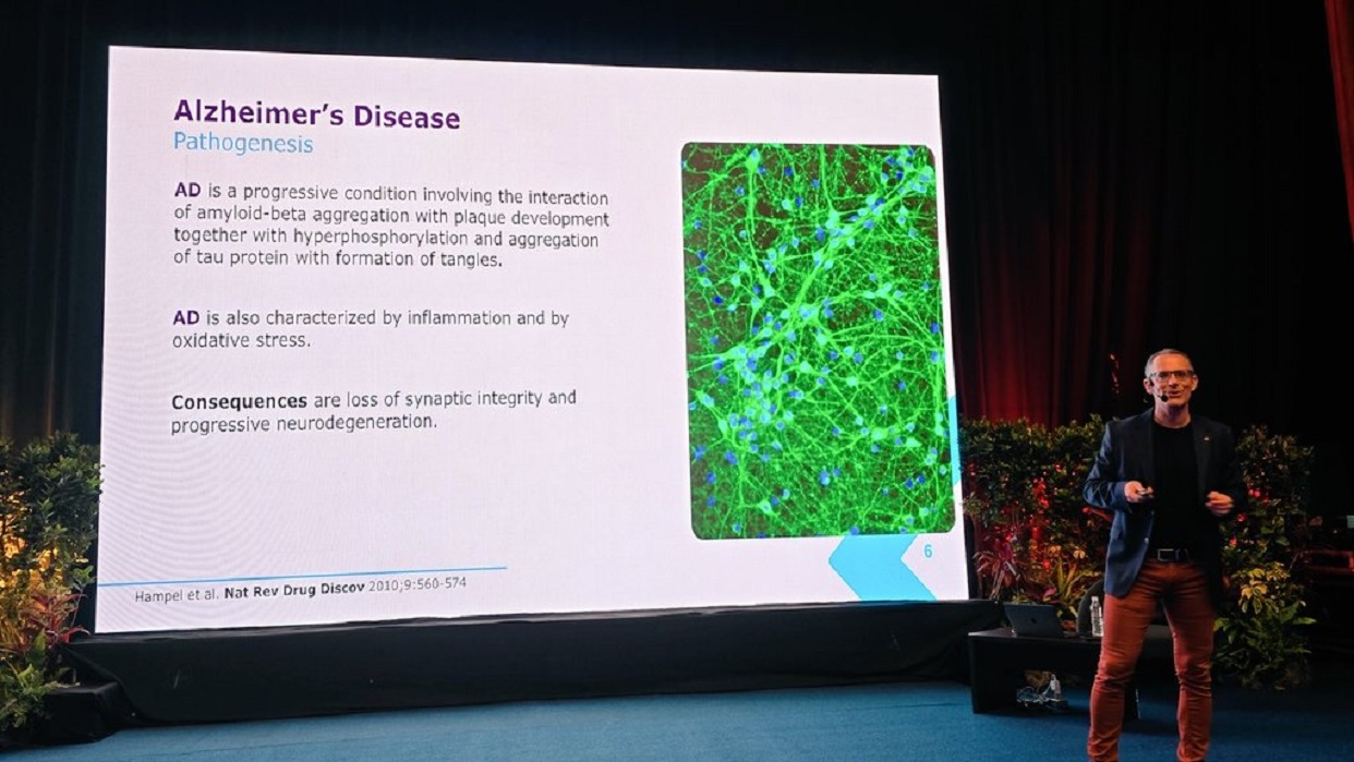 ¡Buena noticia! Venezuela iniciará estudio para diagnóstico temprano del Alzheimer