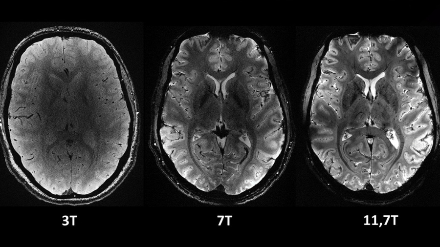 La resonancia magnética más potente del mundo muestra sus primeras imágenes