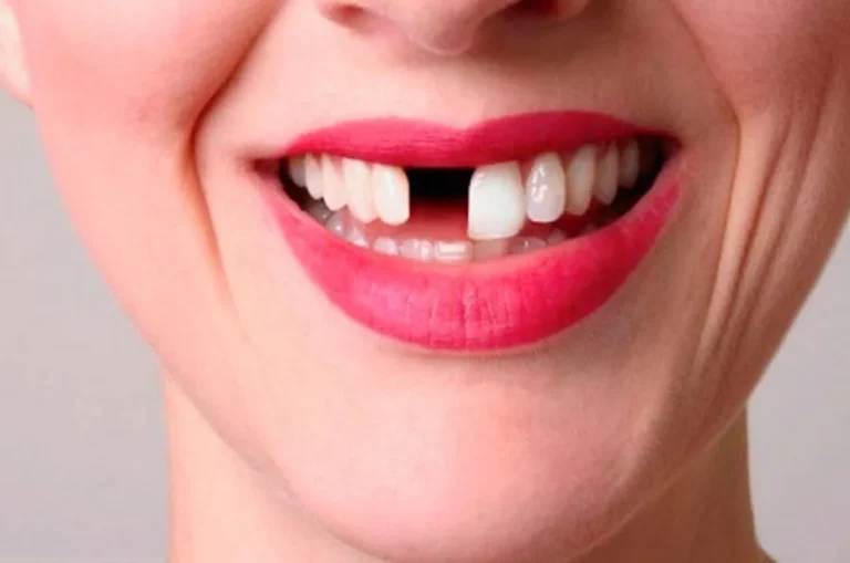 Empezarán con los ensayos del primer fármaco para hacer crecer los dientes (+ Detalles)