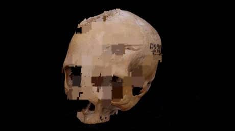 «Un hito en la historia de la medicina»: Documentan una cirugía de hace 4.000 años para tratar el cáncer