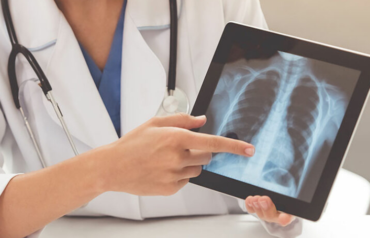 Crean microrobots nadadores que llevan medicamentos a los pulmones con tumores