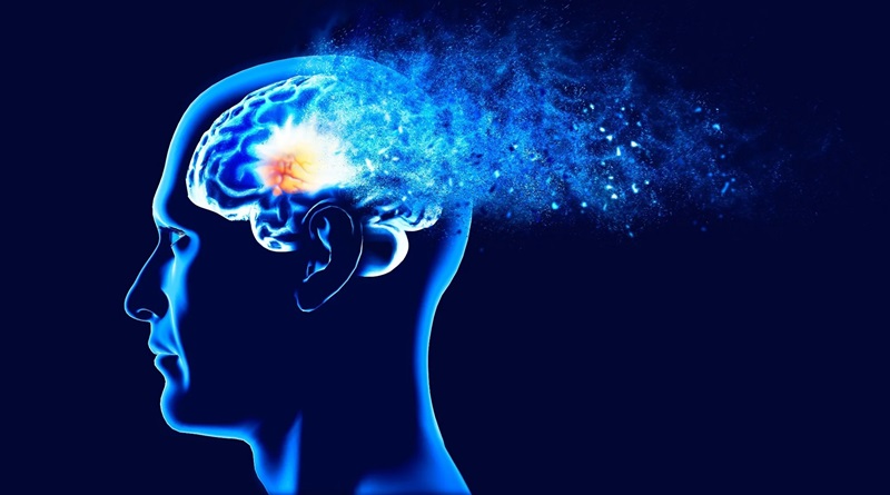 Inteligencia artificial mejora detección temprana de la demencia (+ Foto)