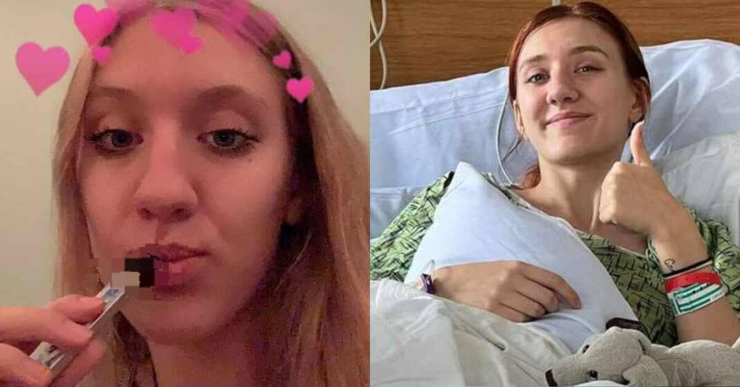 Joven de 20 años le colapsan dos veces los pulmones por el väpper