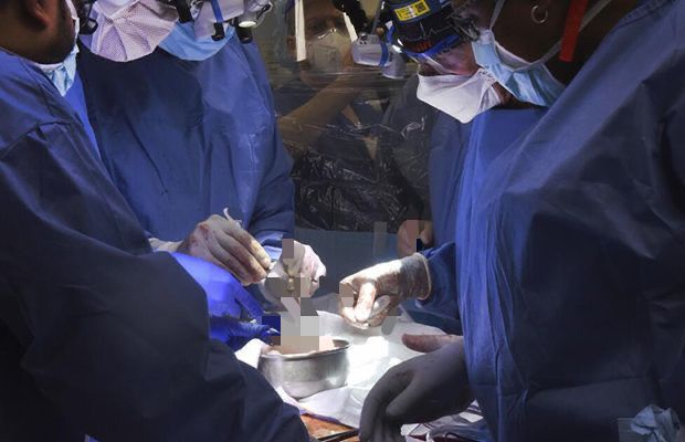 Realizan primer trasplante de un corazón de titanio en EEUU