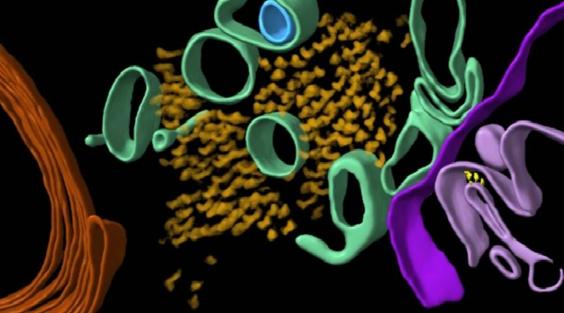 Revelan por primera vez estructura molecular del alzheimer en el cerebro