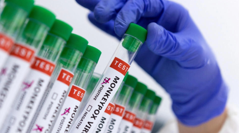 Instituto Pasteur realizará pruebas y vacunas contra viruela símica