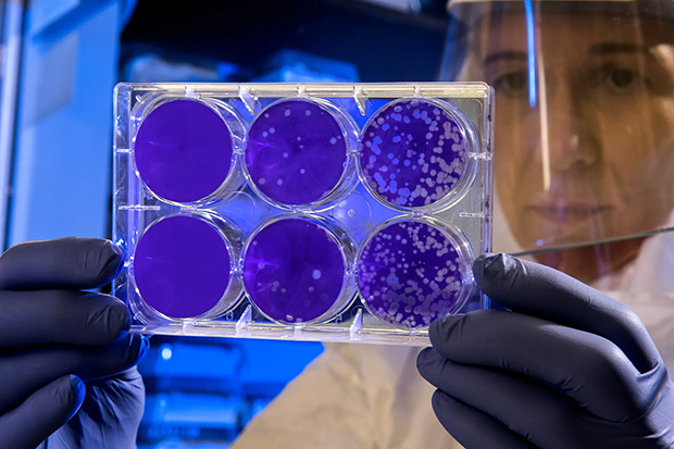 Microbios alimentados con energía renovable transforman el CO2 en proteínas