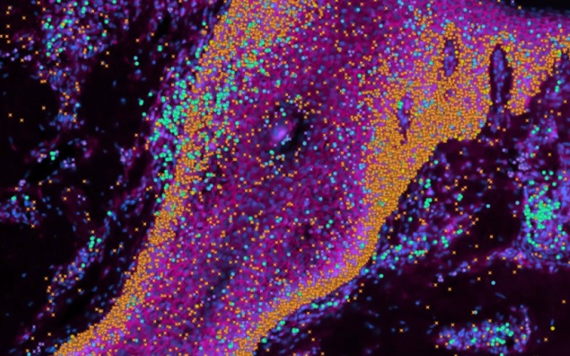 Mapa unicelular de la piel aporta una receta para reconstruirla y prevenir cicatrices