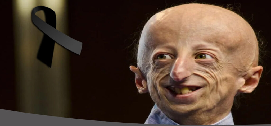 Fallece Sammy Basso a los 28 años, la persona con progeria más longeva del mundo