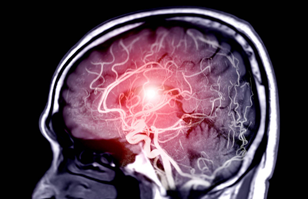 Muestran cómo cambia el cerebro durante la menstruación