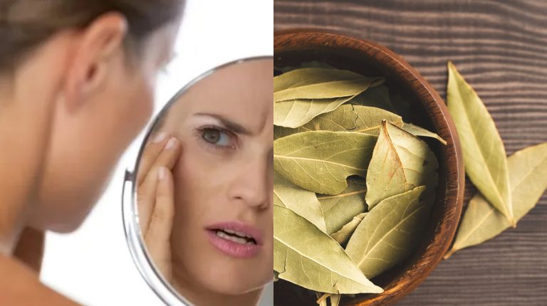 Uso del Laurel: entérate cómo reducir las manchas y prevenir el acné con esta especia
