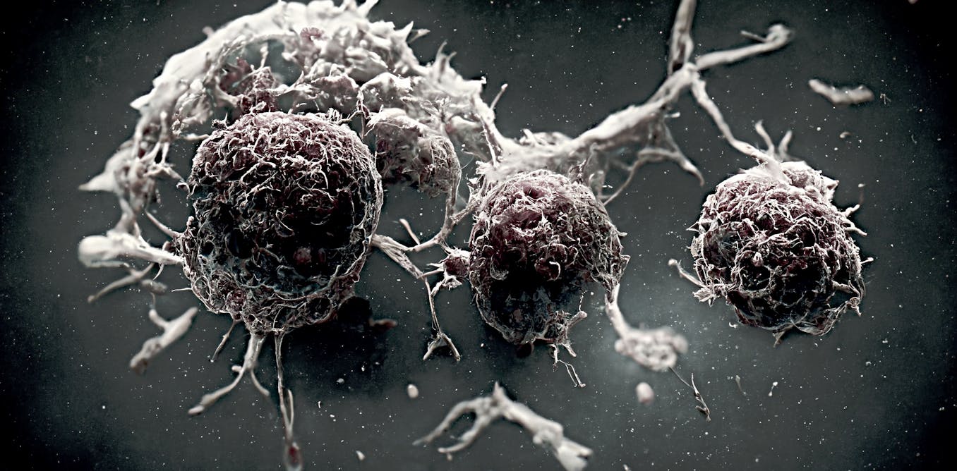 Científicos hallan tratamiento contra el cáncer en cuatro tipos de tumores