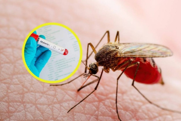 Revolucionario enfoque genético contra la malarïa: un parásïto modificado podría ser la clave para una vacuna efectiva (+ Detalles)