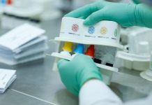 En Venezuela Desarrollan nuevos kits de diagnóstico de VÏH y hepatitïs