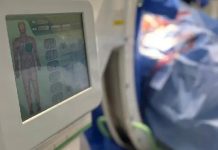 Pacientes fueron beneficiados en el estado Trujillo con una jornada de colocación de marcapasos para varios pacientes