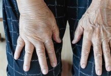 Conoce cuál es la fruta que cômbate la retênción de líquidos y ayuda a eliminãr toxinâs de forma natural (+ Detalles)