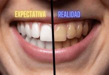 Salud bucal vs. filtros: la prêsión estética de las redes sociales (+ Detalles)
