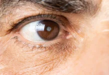 Muchas personas mayores têmen la cirugía de câtaratâs (+ Detalles)