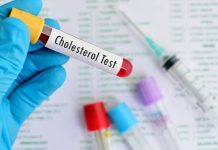 Niveles de colesterÖl en el organismo: ¿Cuándo es bueno o malo? (+ Detalles)