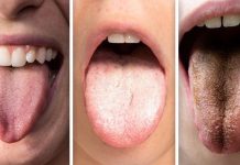 El Color de la lengua puede ser un indicador de posibles problemas de salud