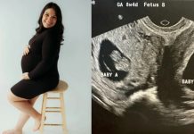 «Una en un millón»: Mujer con doble útero dio a luz a gemelas en días separados